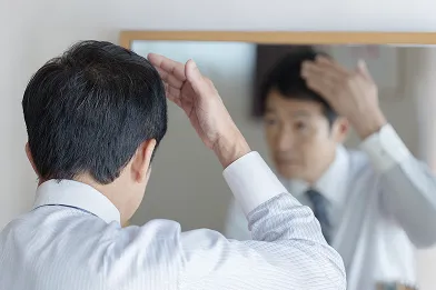 髪の毛が薄くなった